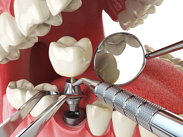 Best Emergency TMJ Treatment in Mapleton, MN